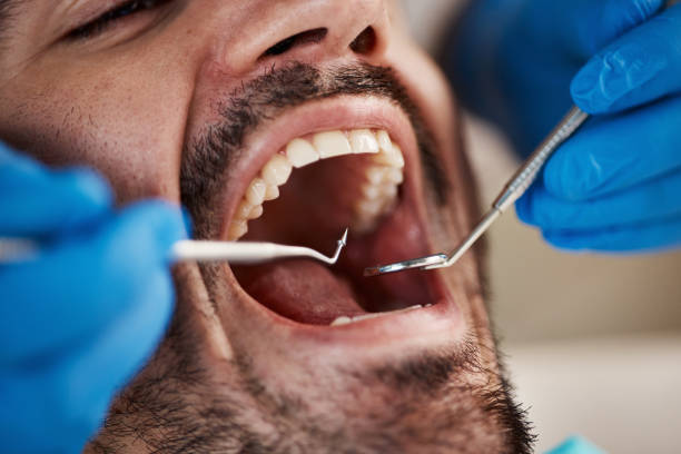 Best Tooth Infection Emergency Dentist  in Willowbrook, CA